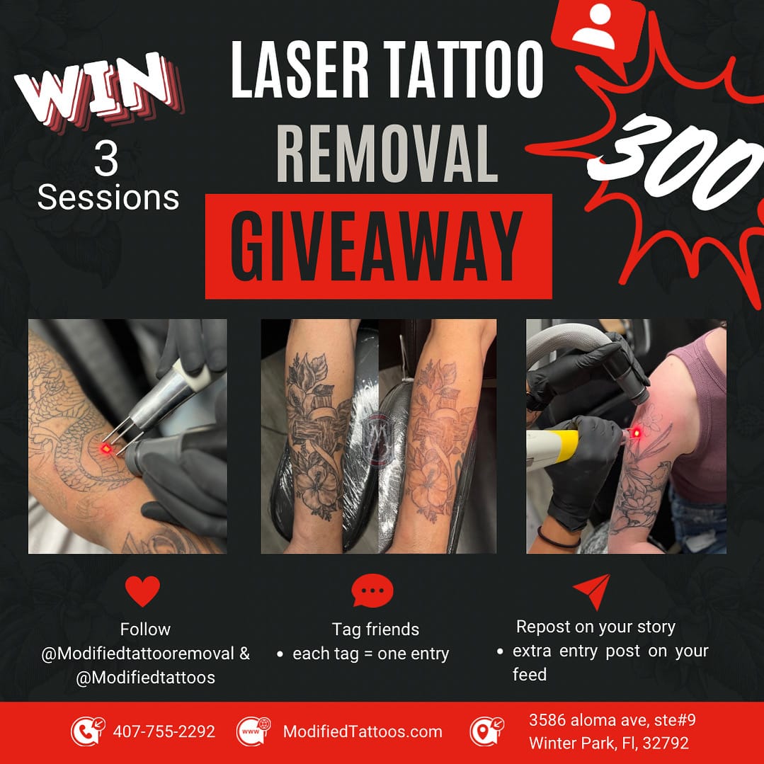 laser tattoo removal giveaway